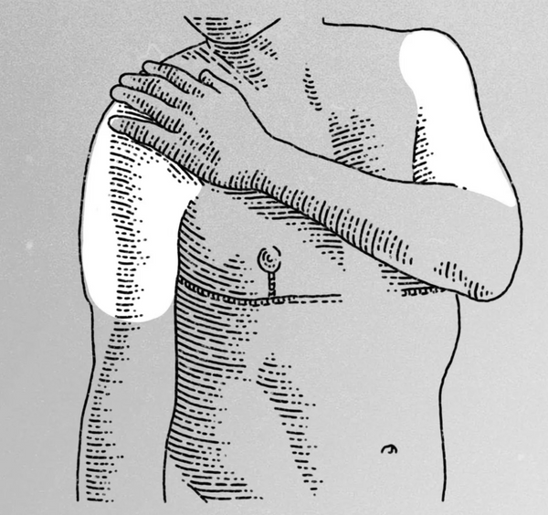 Testosterone Gel for Gender-affirming Hormone Therapy: What, Where, and How